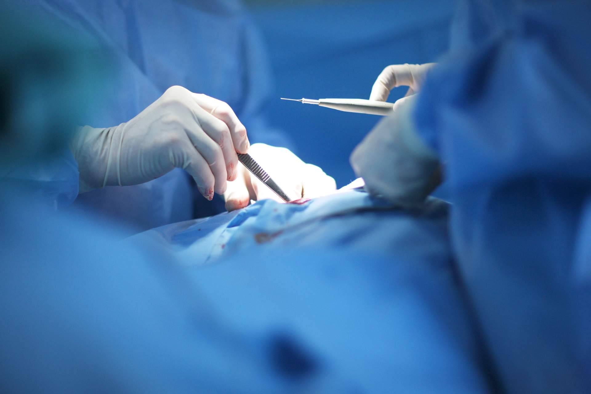 Tratamiento del quiste pilonidal con técnicas modernas, de la mano de Innova Cirugía