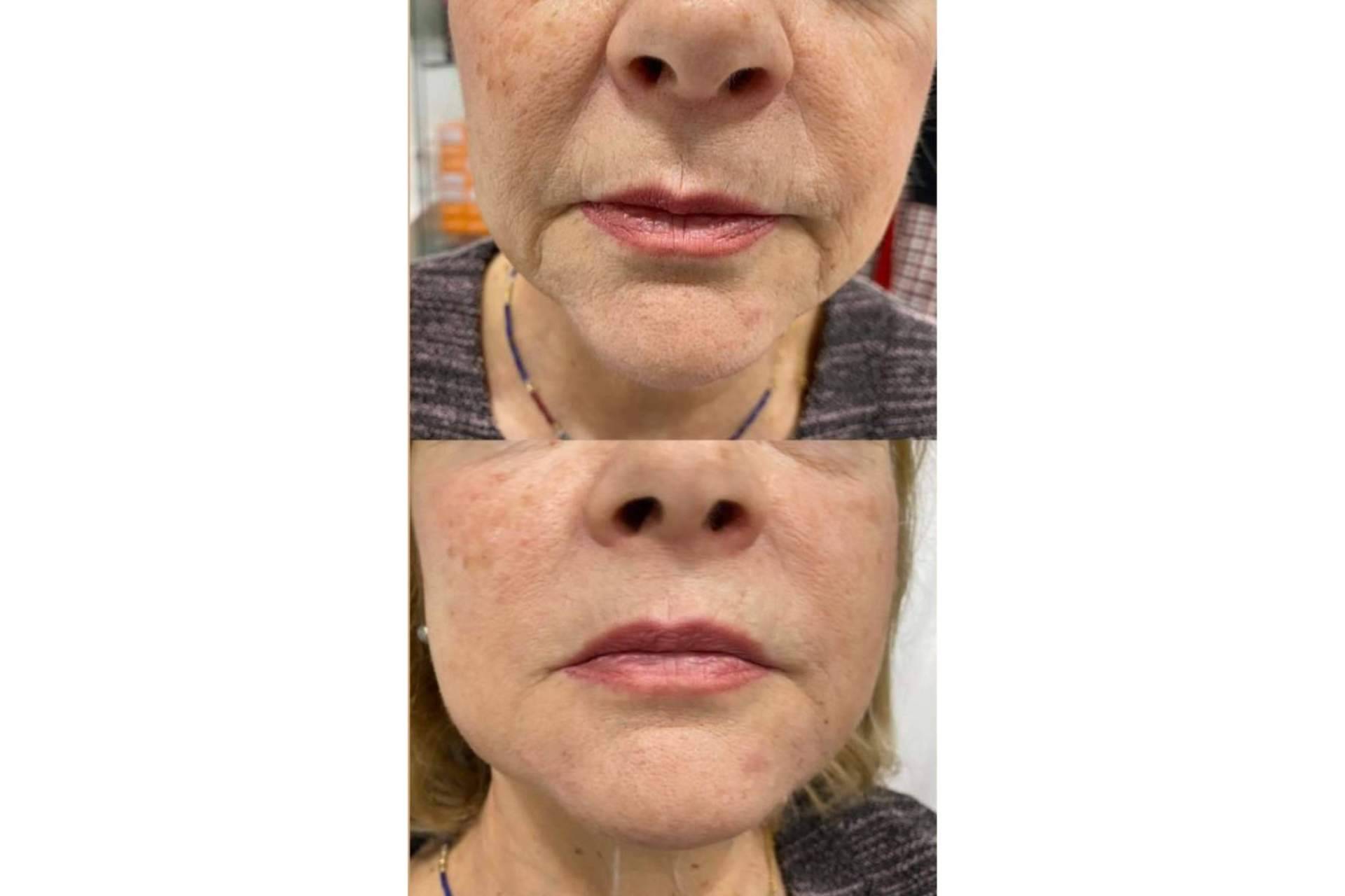 Clínica Amalfi y su tratamiento facial completo para mejorar el aspecto de la piel