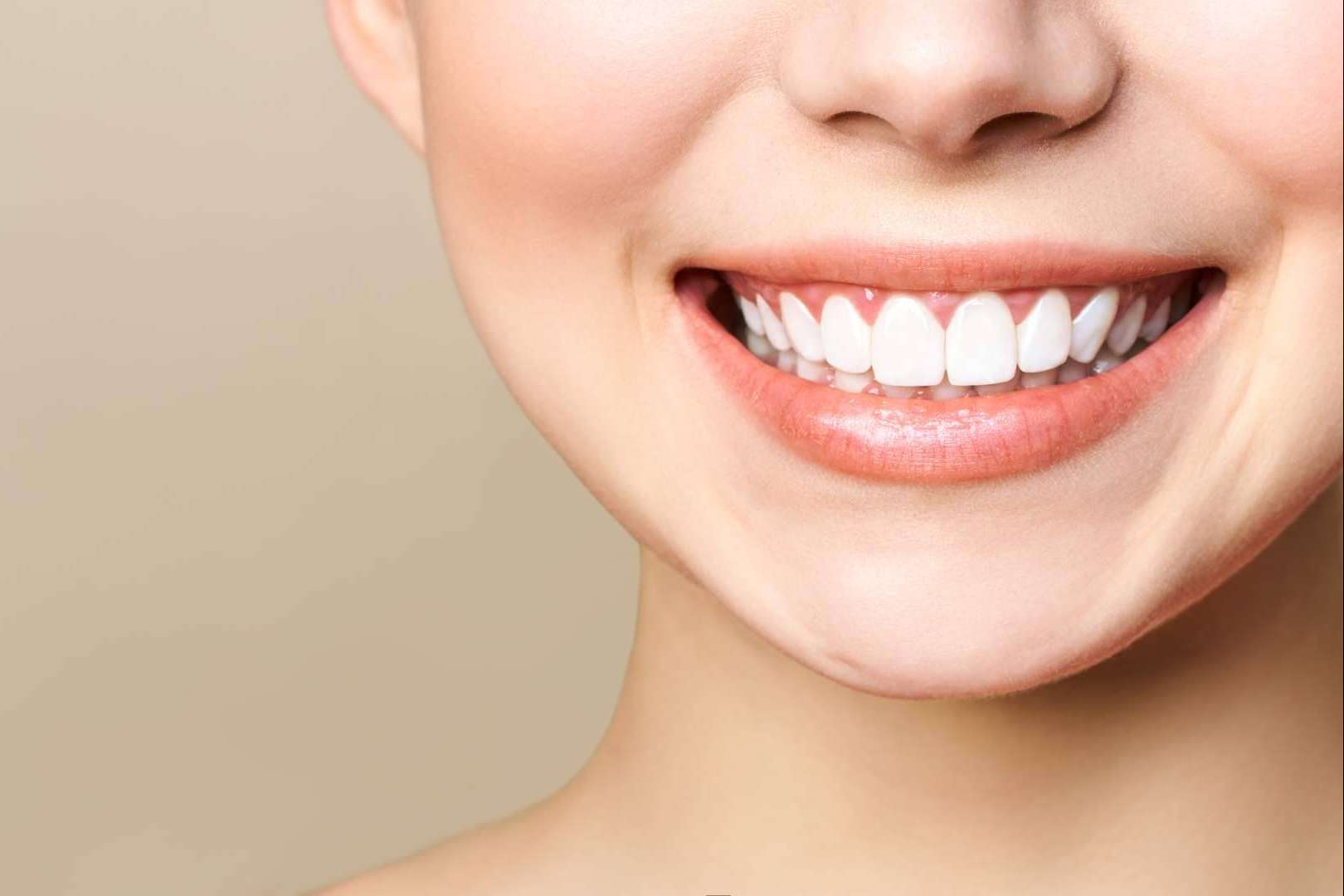Qué son las carillas de composite, por Carlos Saiz Smile