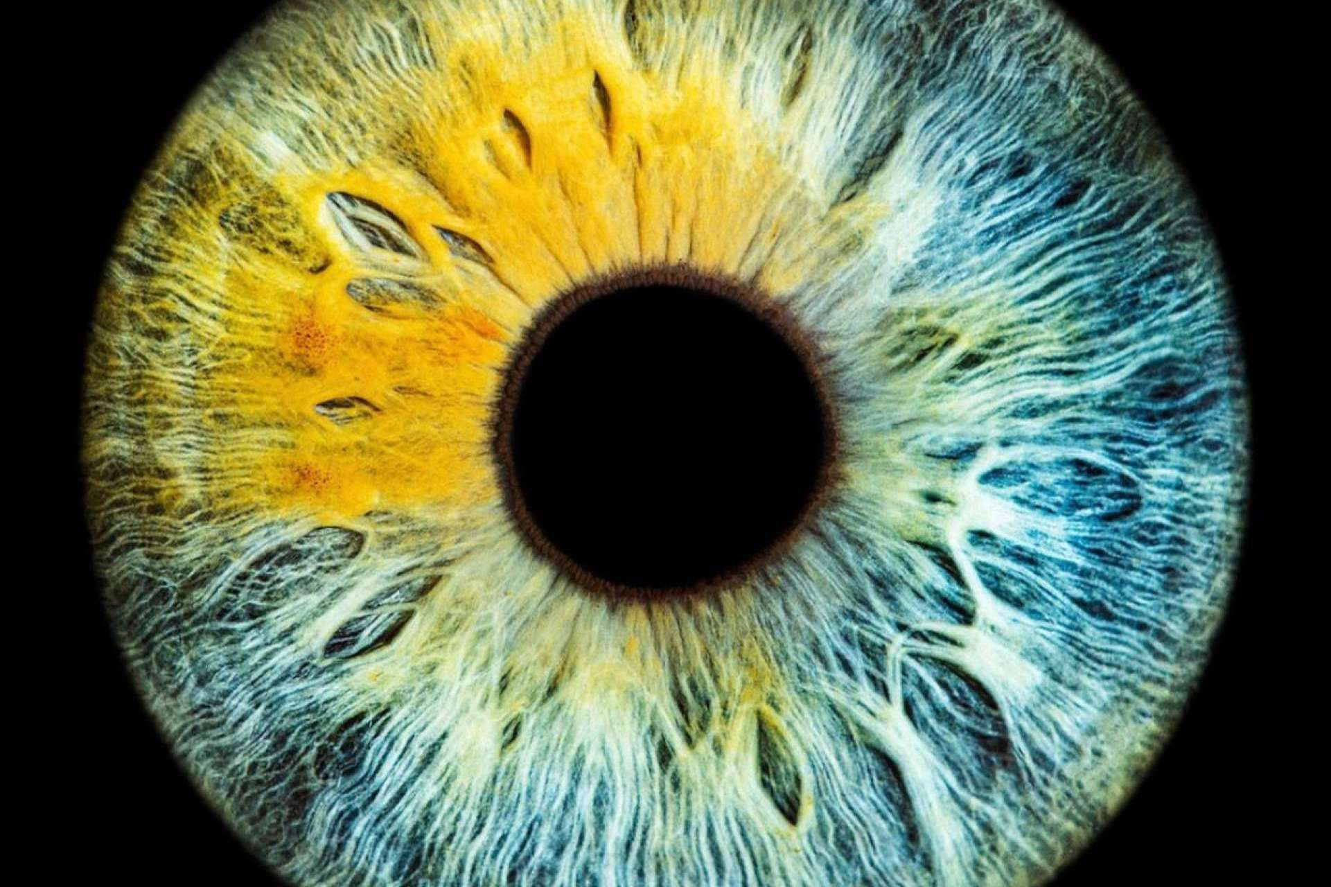 Perfil psicológico sano de los pacientes que llevan a cabo el láser de cambio de color de ojos