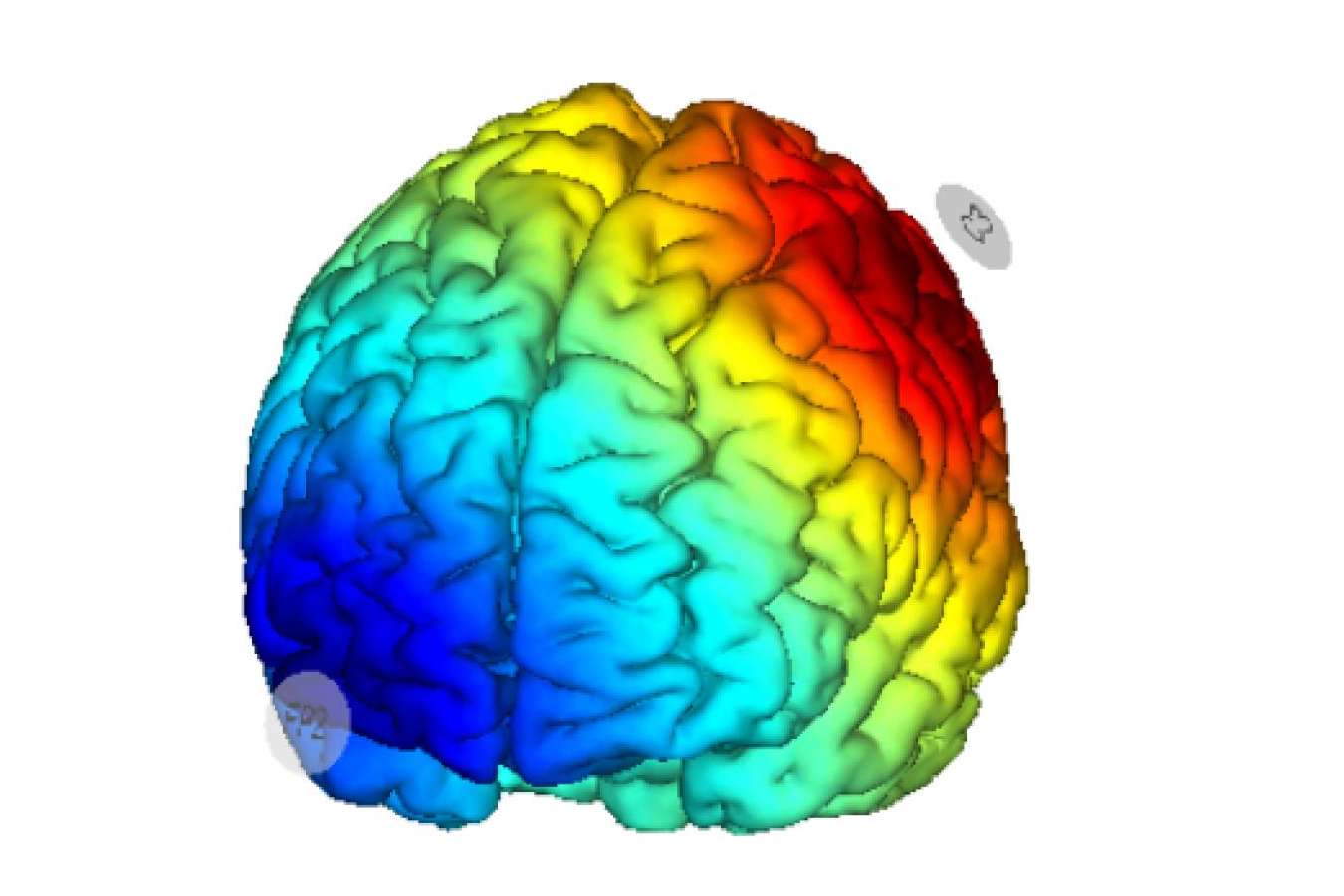 Innovador enfoque para el tratamiento de la fibromialgia; estimulación cerebral no invasiva
