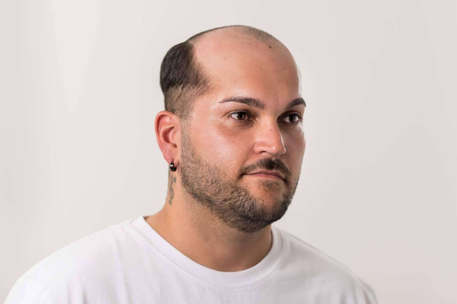 Un mercado en auge, las prótesis capilares para hombre con Hair Inspira