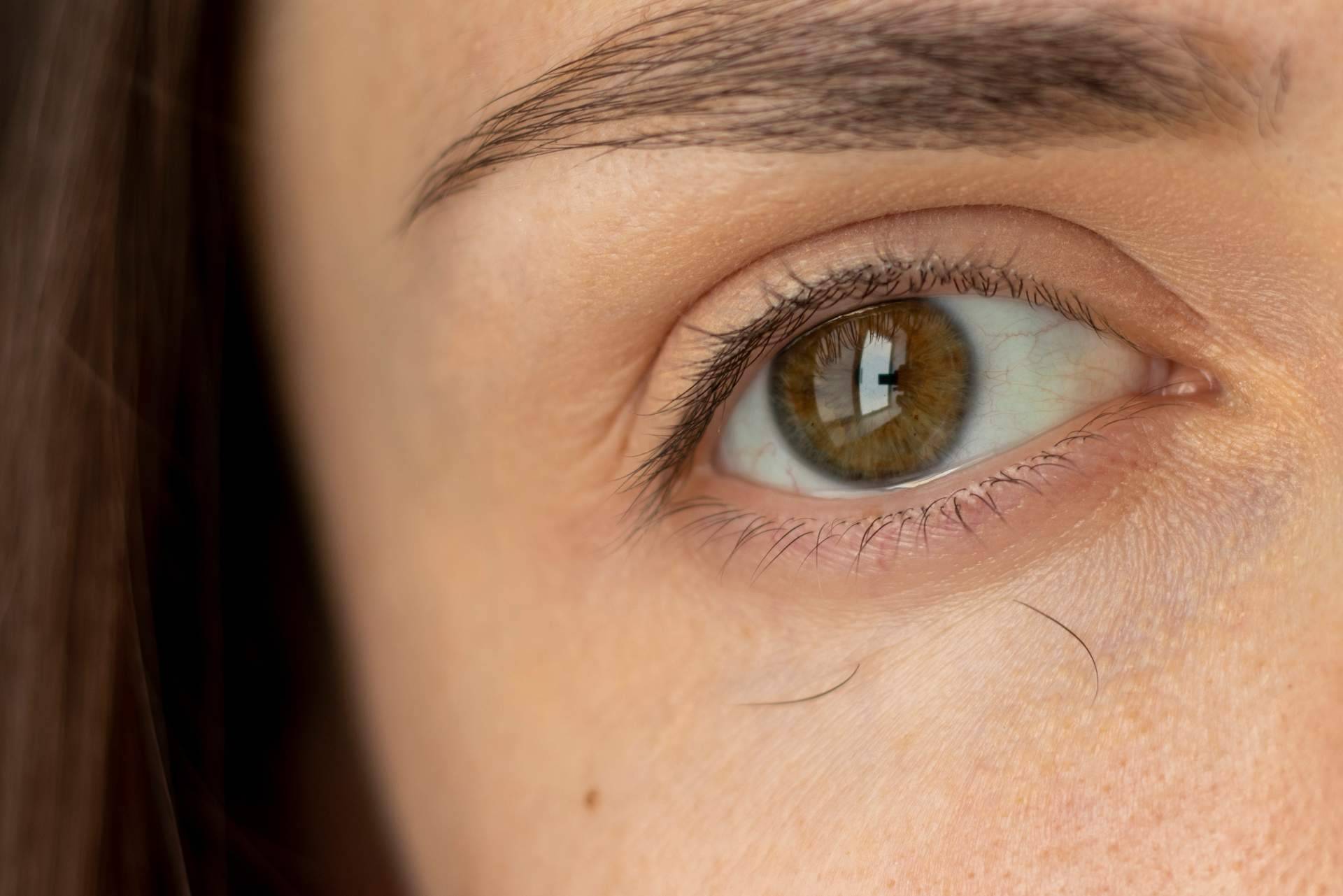 ¿Por qué se cae el pelo de las cejas? La explicación del Doctor Jesús Mora y Capilar Innovation Clinic