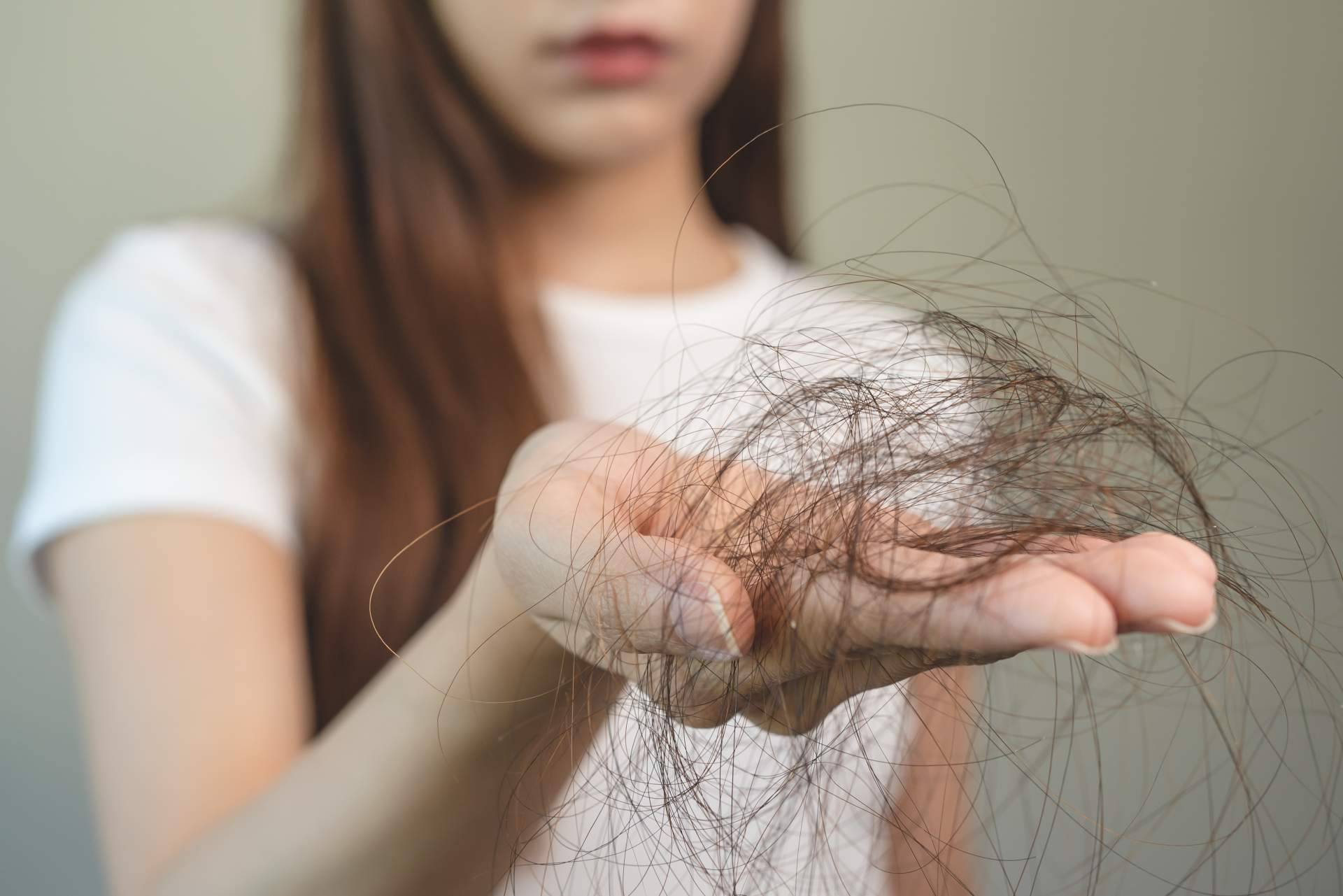 Evocapil ayuda a prevenir la pérdida de cabello