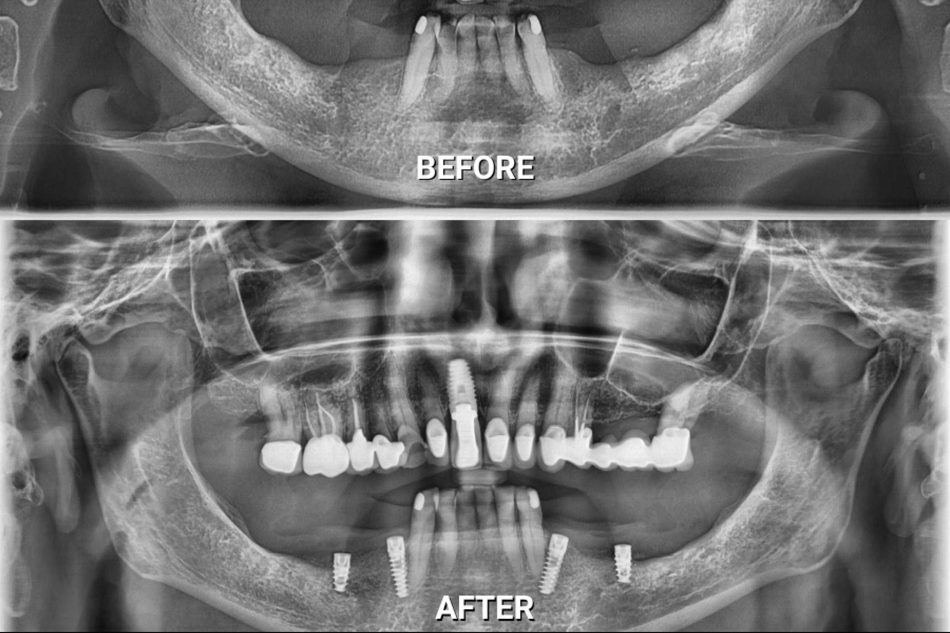 El crecimiento de la odontología integral, biológica y regenerativa en Puerto Vallarta, México