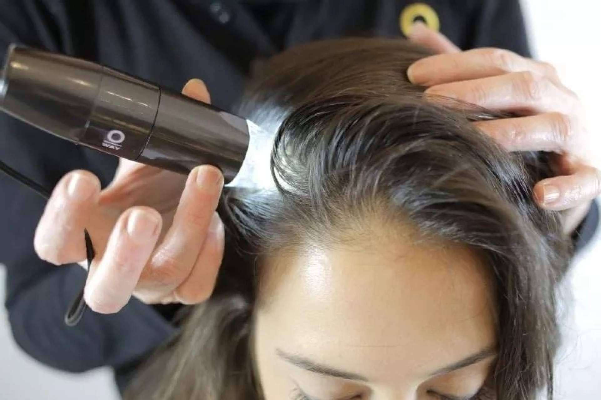 IMD lleva más de 20 años poniendo solución a la alopecia areata