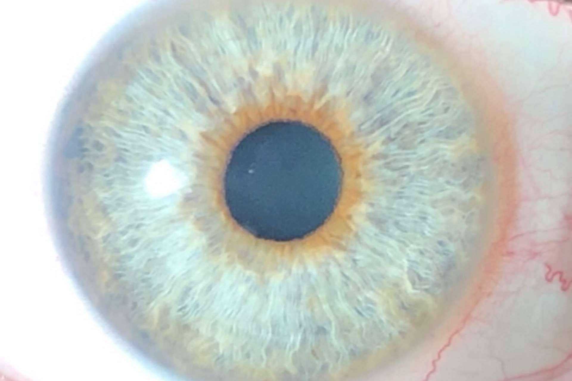 Distribución del color de ojos de la mano de Eyecos