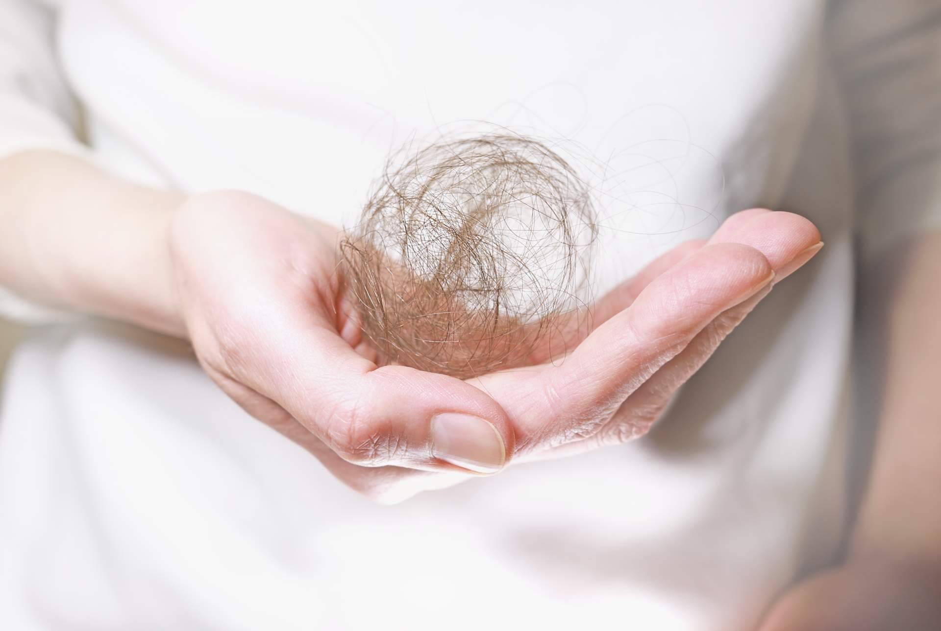 La solución de Capilar Innovation Clinic para la alopecia andrógenetica femenina