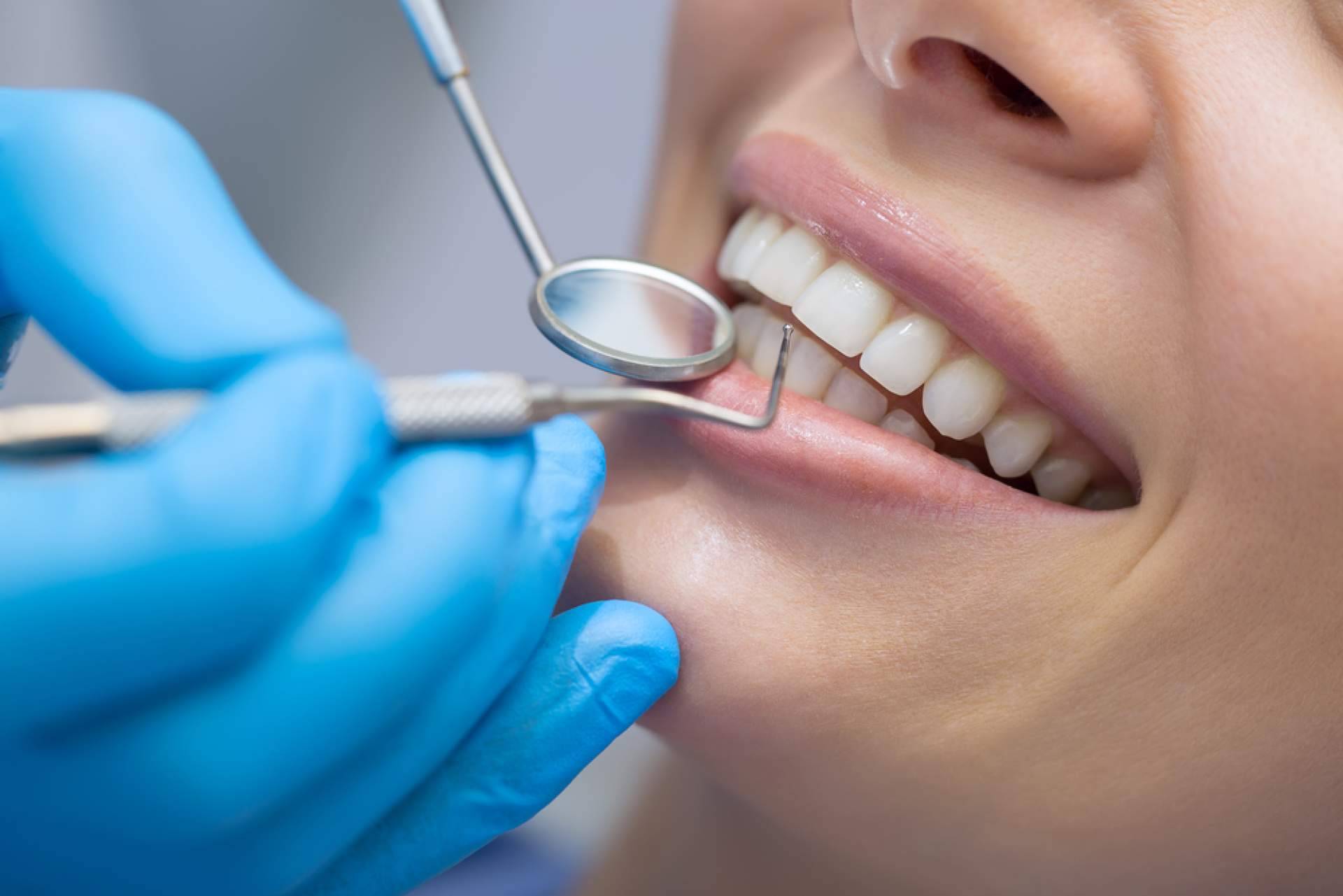 Clínica Dentinos, expertos en la aplicación de carillas dentales en Málaga