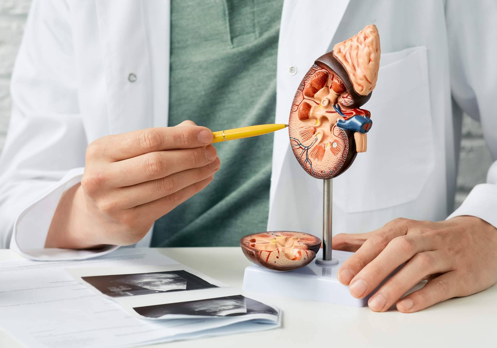 Causas, diagnóstico y tratamiento del cáncer de riñón, por el Dr. Nelson Díez
