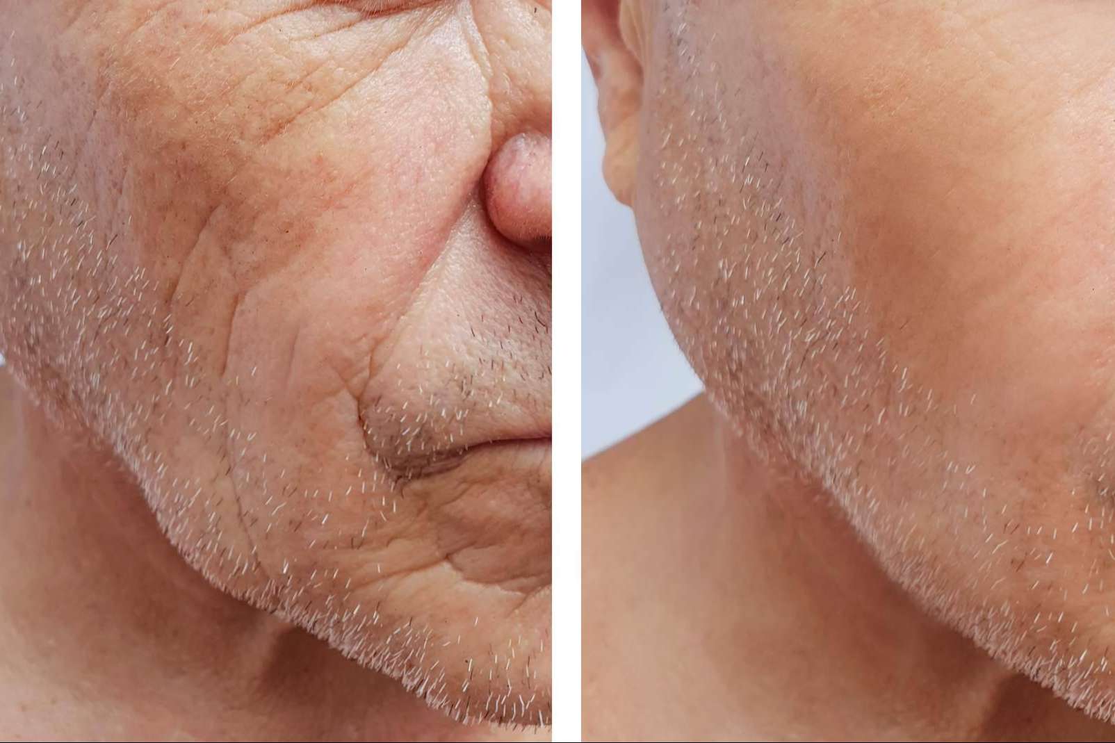 Terapias para eliminar las células senescentes, de la mano de COEUS Retroaging