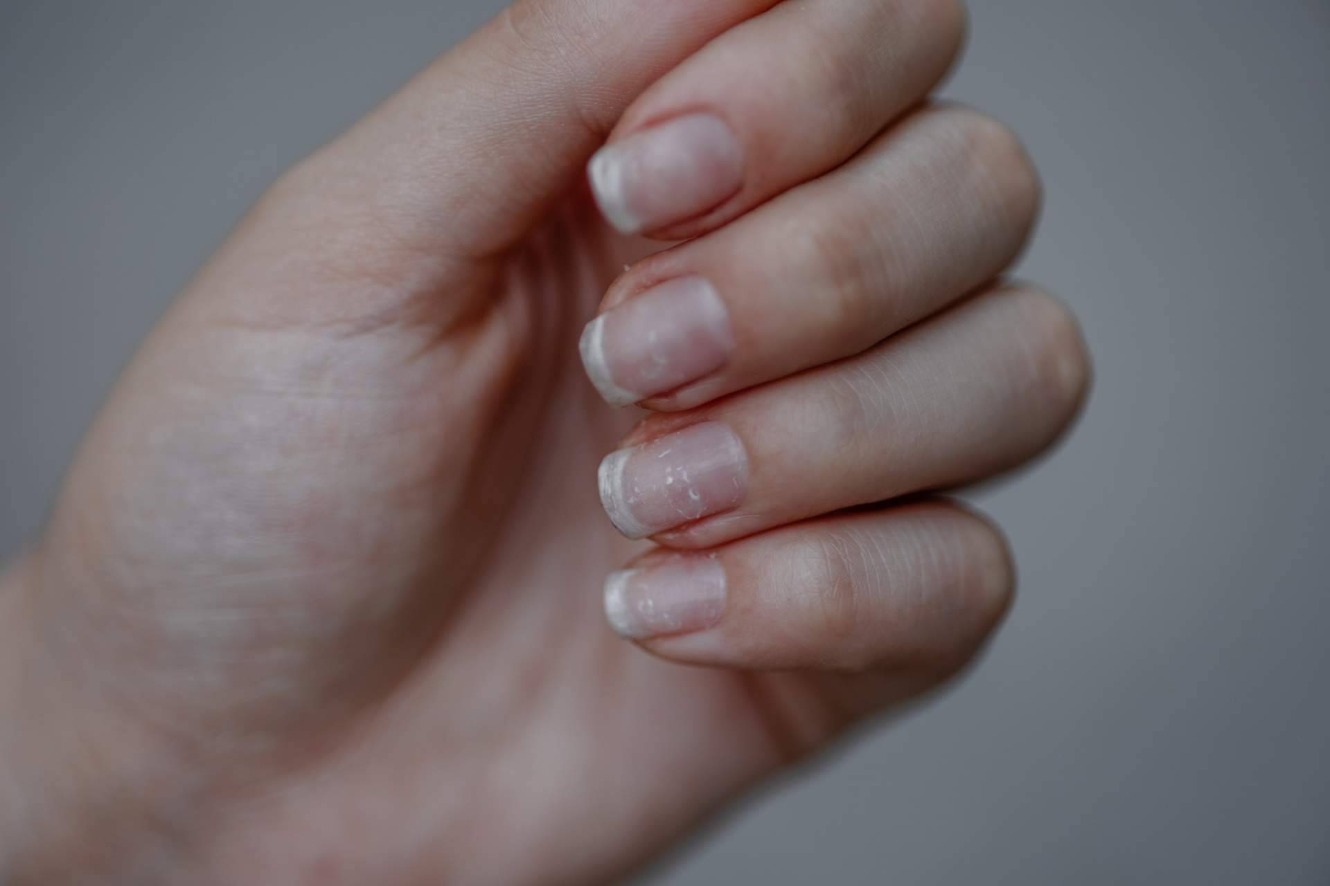 Lazonail® es un tratamiento holístico para uñas y cutículas
