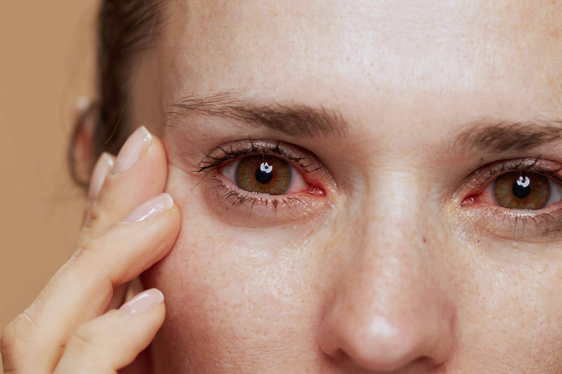 Soluciones avanzadas para el ojo seco en el Hospital Universitario Dexeus Barcelona