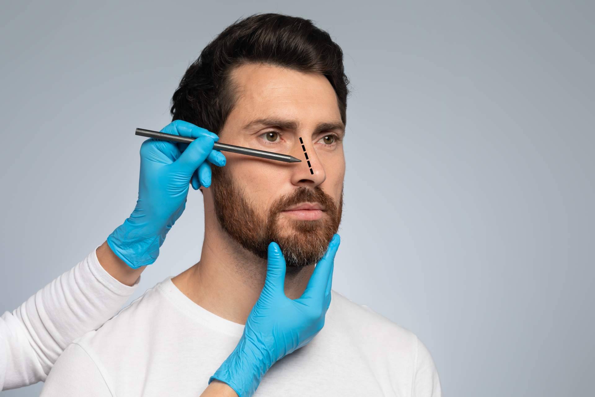 Nariz nueva con la rinoplastia ultrasónica, la cirugía precisa para corregir el caballete