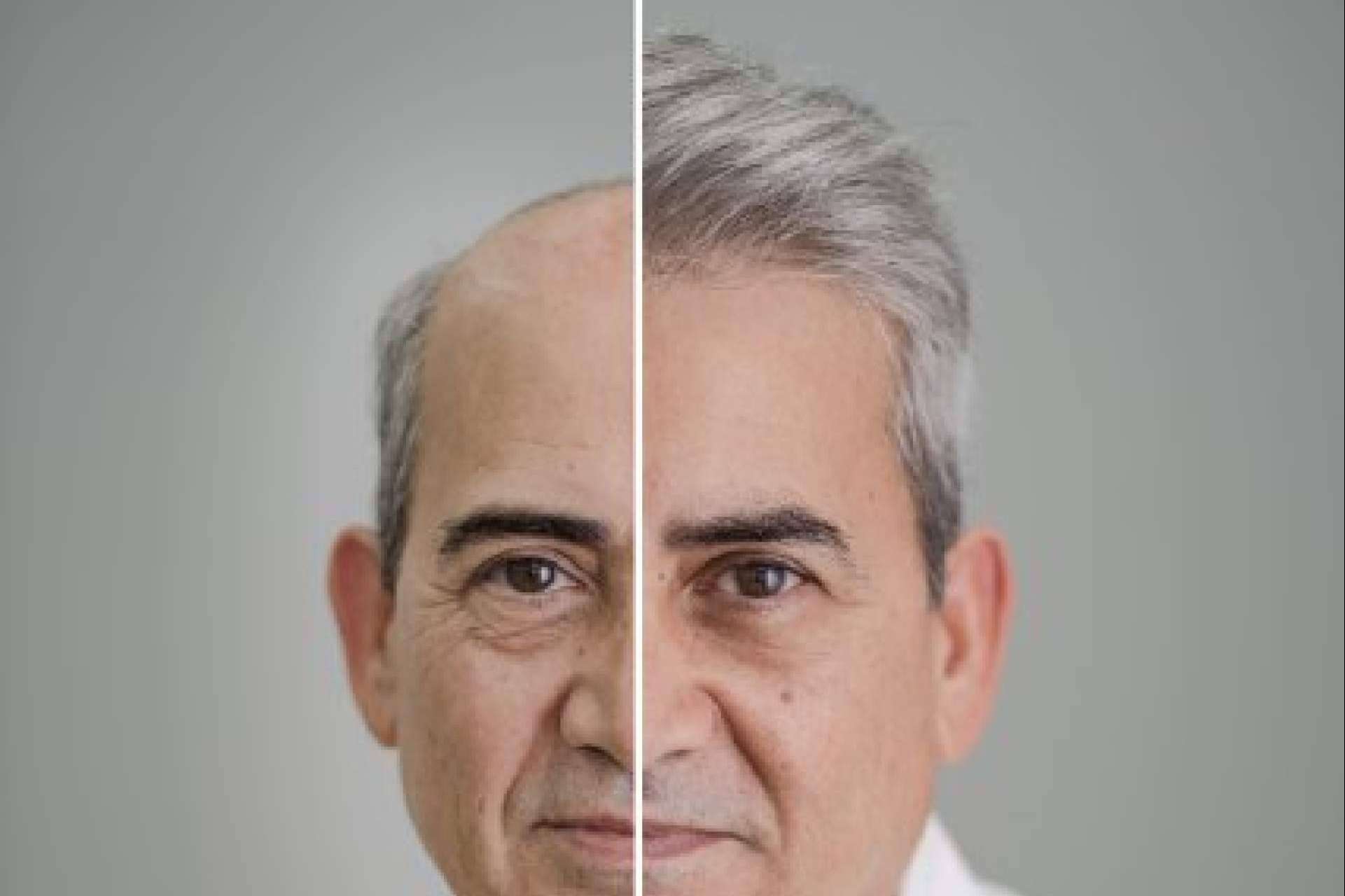Hair Inspira, expertos en prótesis capilares