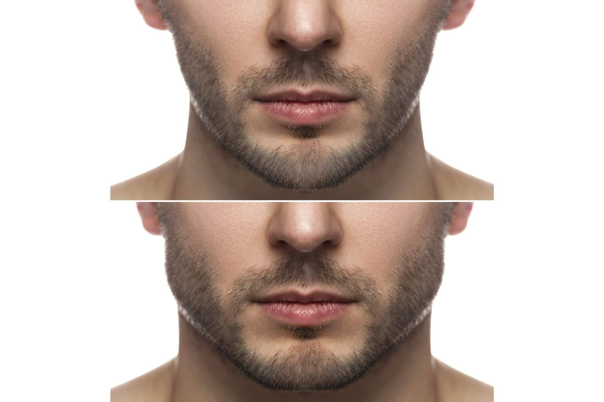 Medicina estética masculina, ¿cuáles son las nuevas tendencias y enfoques personalizados?