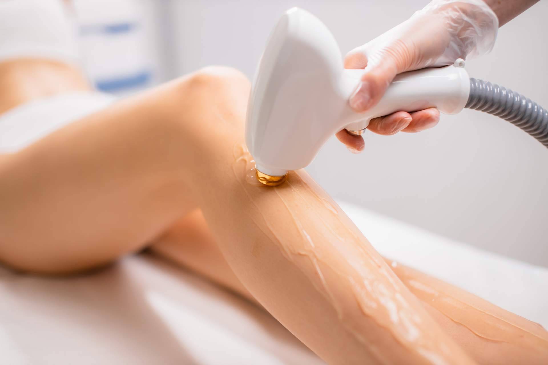 360Clinics ofrece consejos para minimizar el riesgo de efectos secundarios en la depilación láser de piernas