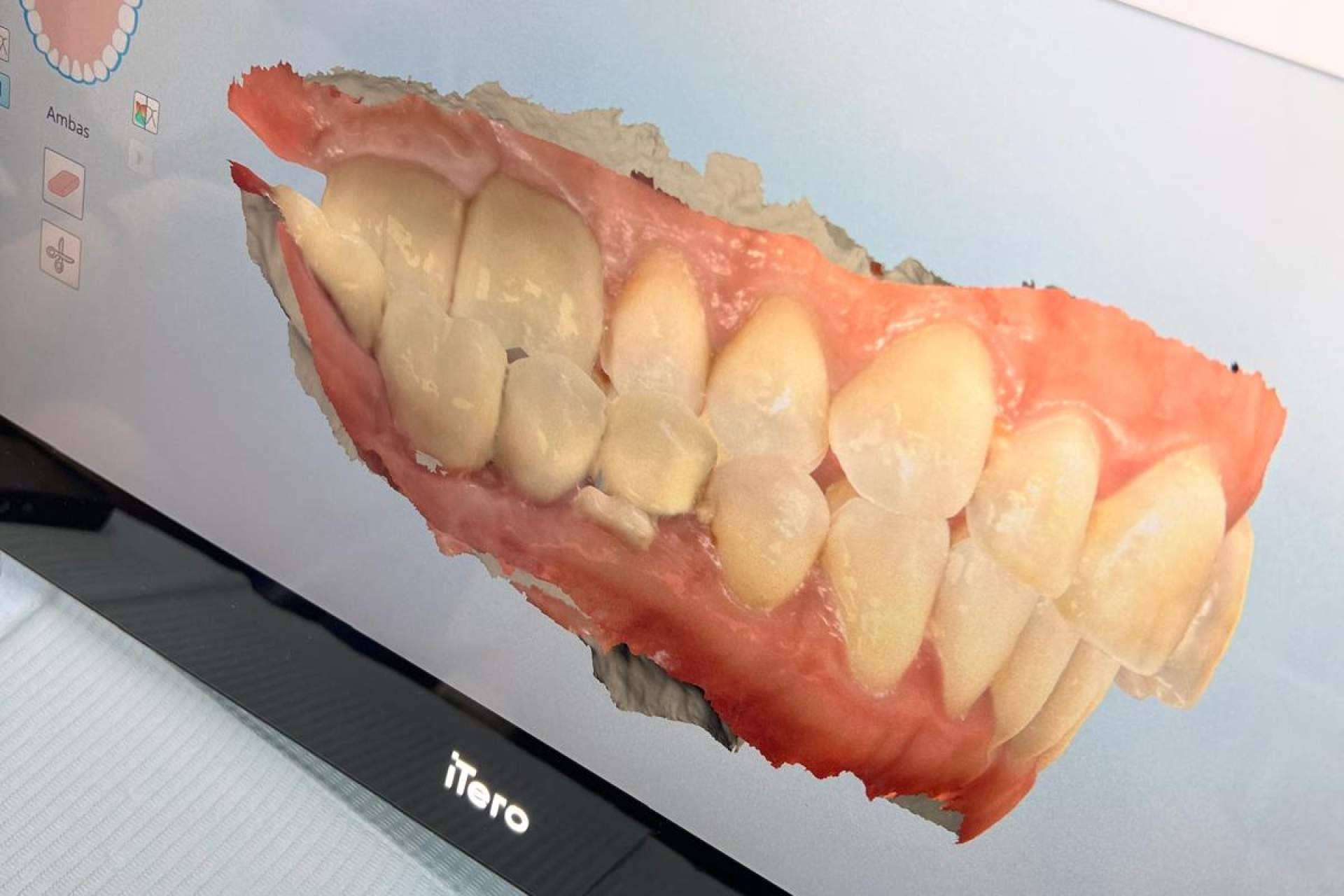 Clínicas Nobel ofrece simulaciones dentales precisas y tecnología de última generación
