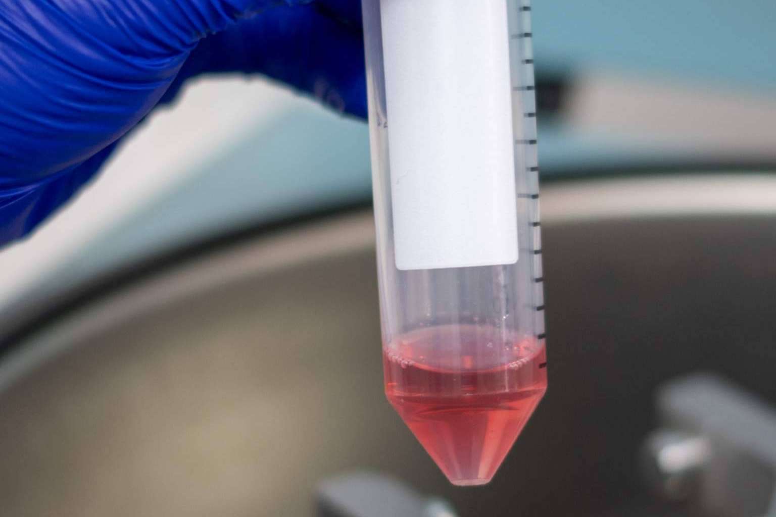 Oncovix; Una Ventaja Clave para Combatir la Recaída en el Cáncer