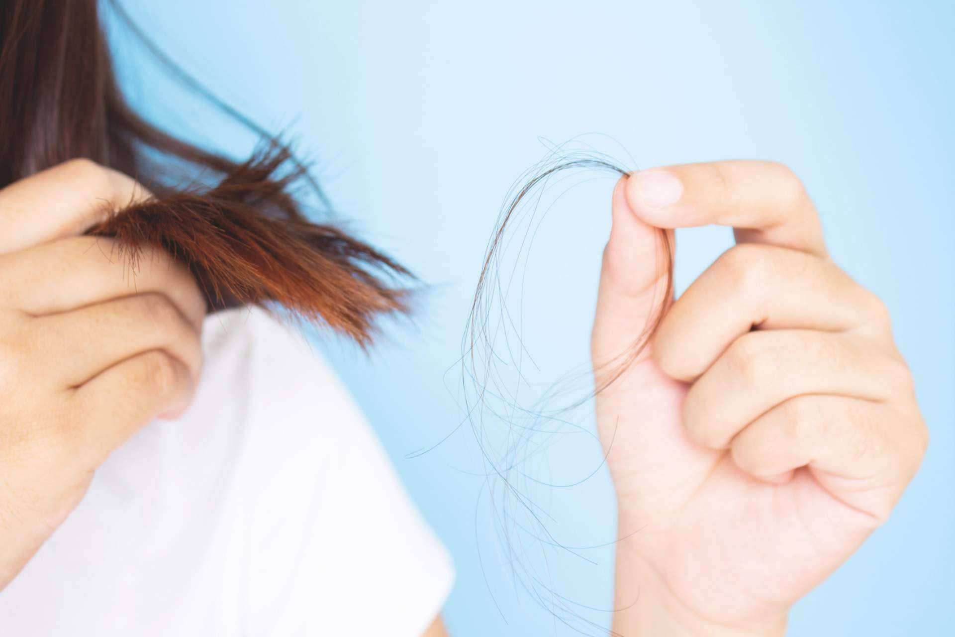 Los tipos de alopecia más comunes y cómo se manifiestan