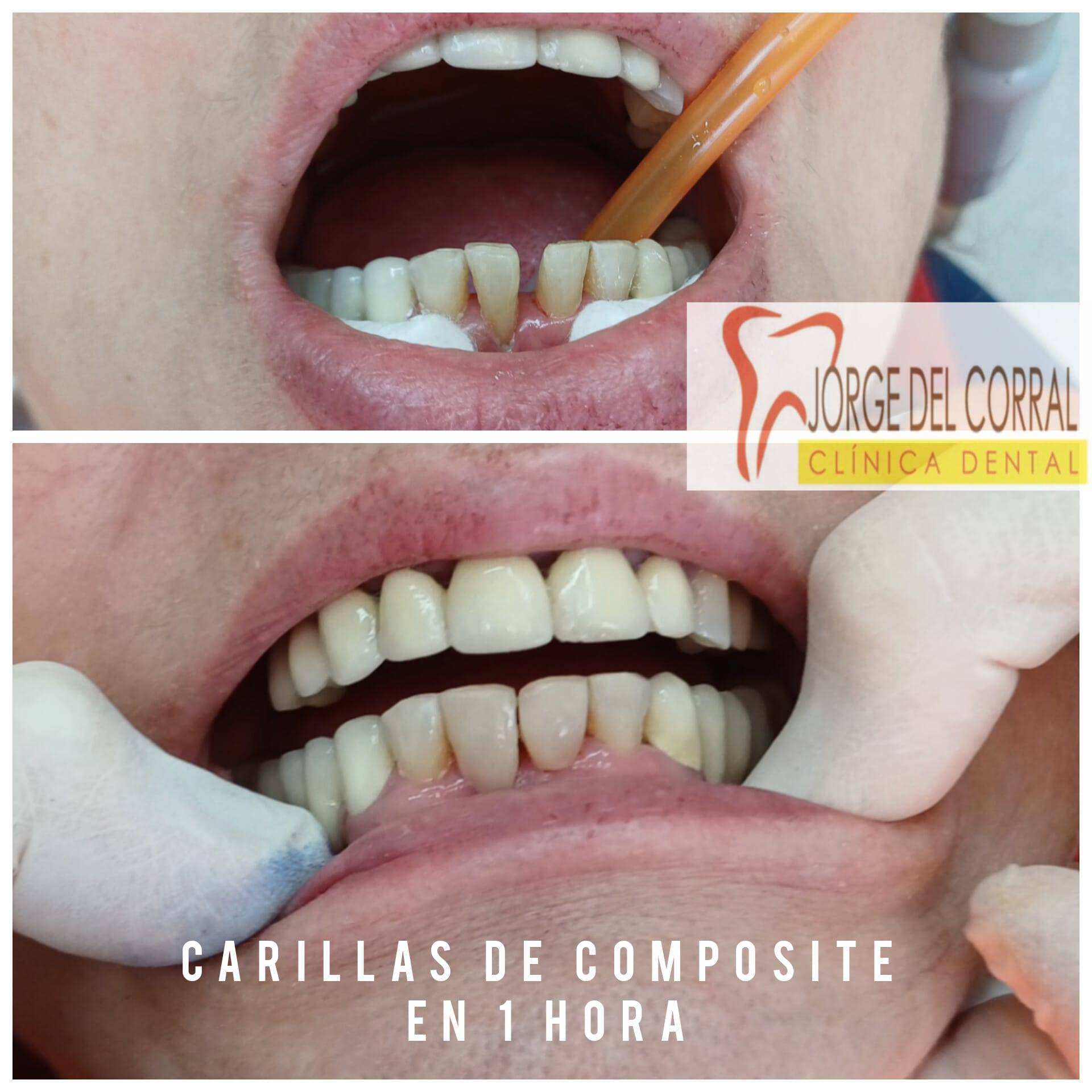 Jorge del Corral, la clínica dental de referencia en Hortaleza para estética y salud bucodental