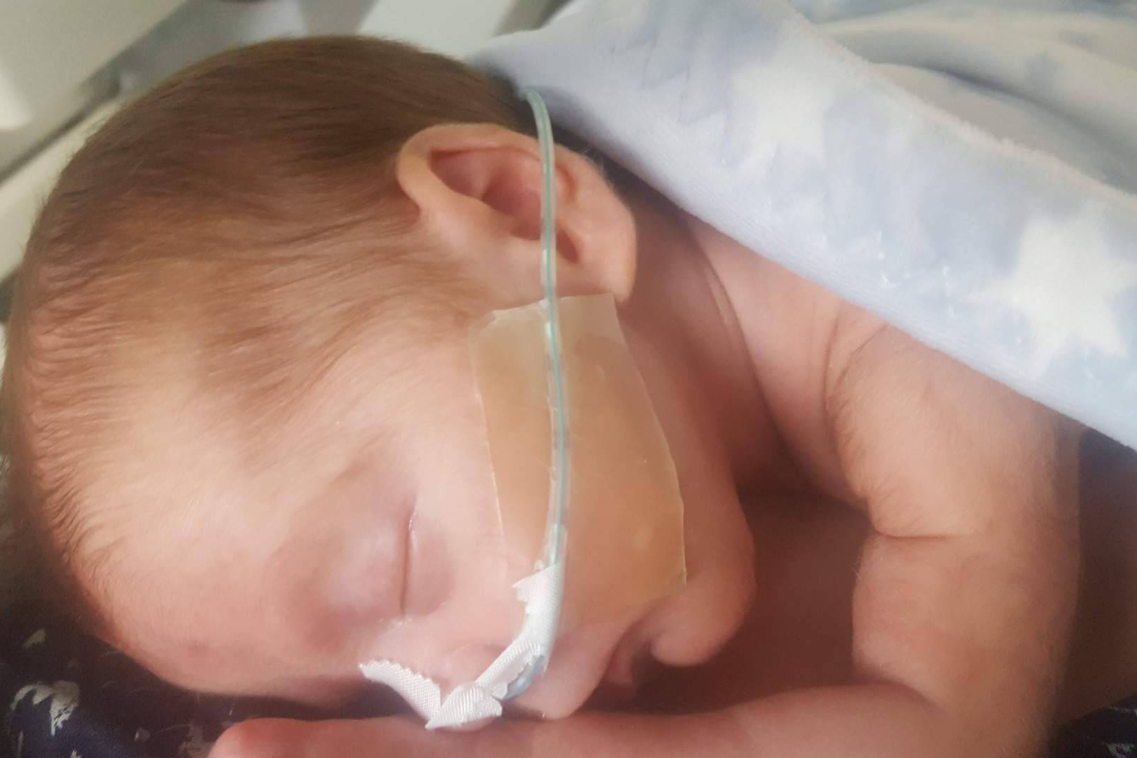 Día Mundial de la Prematuridad; detrás de cada bebé hay una familia que no se rinde